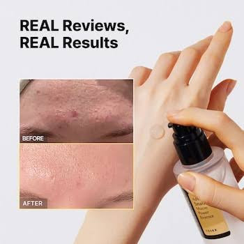 اسنس حلزون کوزارکس مدل Advanced Snail 96 Mucin Power Essence