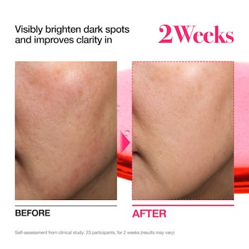 سرم نیاسینامید آنوا (Anua Niacinamide 10% + TXA 4% Serum)