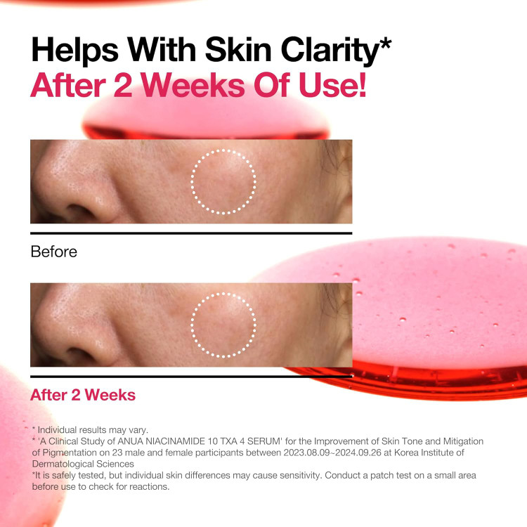 سرم نیاسینامید آنوا (Anua Niacinamide 10% + TXA 4% Serum)